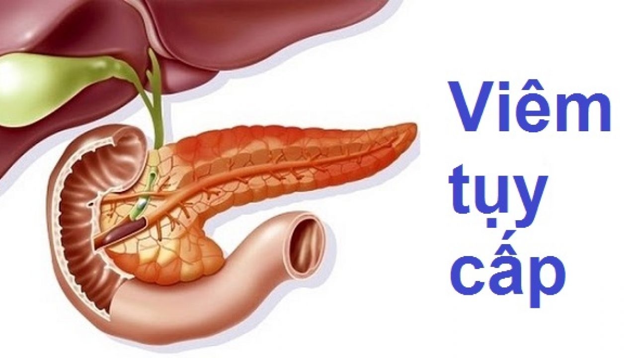 Bệnh viêm tụy cấp và cách chữa trị