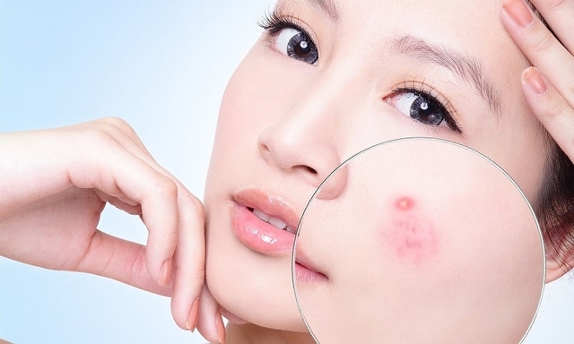 &#8220;Trăn trở&#8221; chuyện tìm phòng khám da liễu uy tín tại Hà Nội?