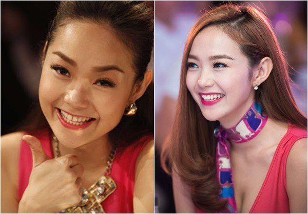 niềng răng Invisalign ở Thu Cúc
