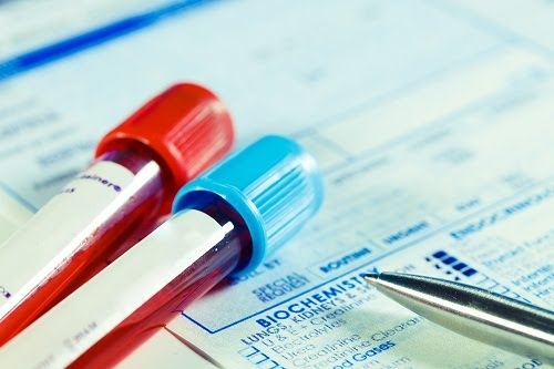 xét nghiệm máu phát hiện chỉ số ggt 