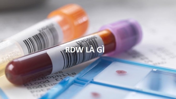 RDW là gì? Khám phá ý nghĩa của chỉ số RDW trong xét nghiệm