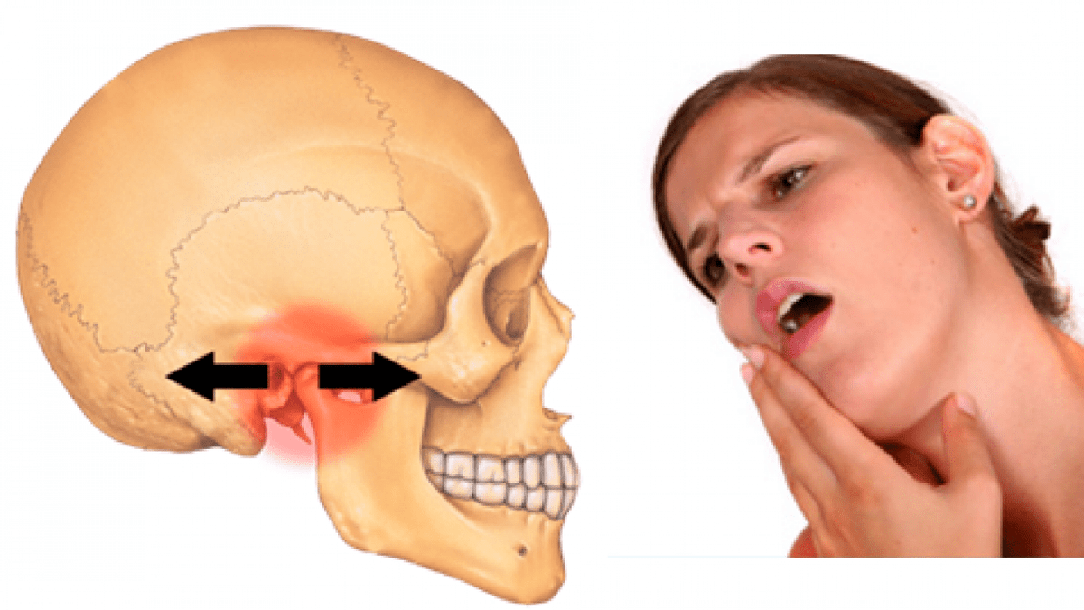Điều trị viêm khớp thái dương hàm