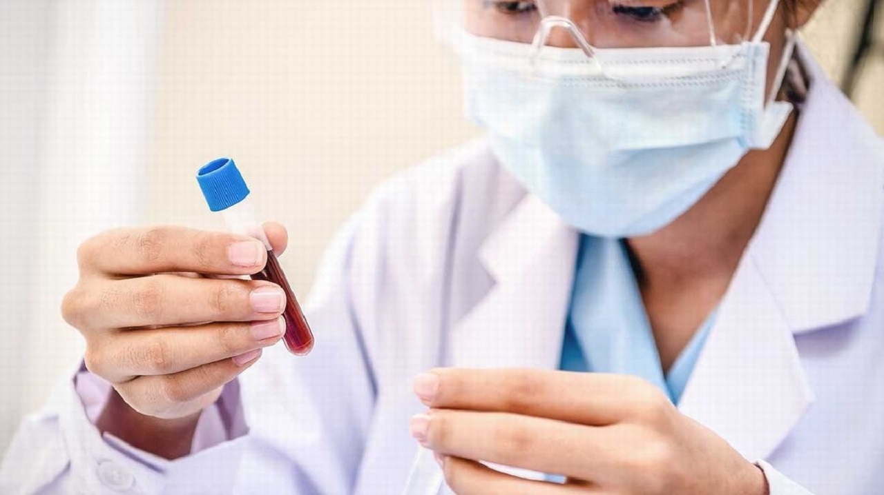 Urobilinogen là gì? Chỉ số Urobilinogen cao