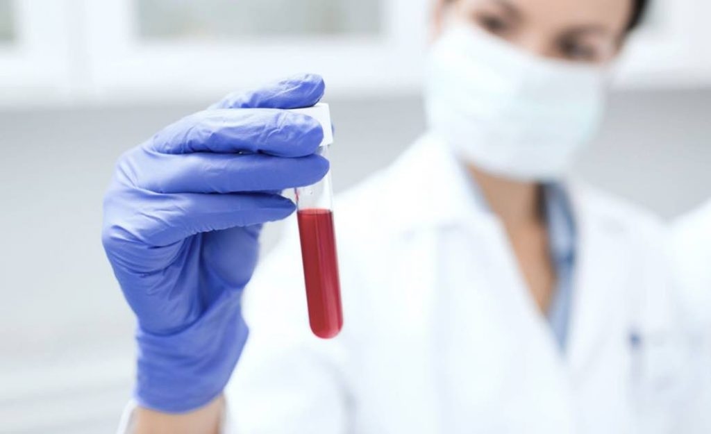 Monocyte là gì? Ý nghĩa của chỉ số Monocyte