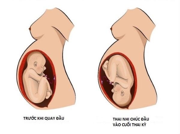 Thai nhi ở giai đoạn này phát triển to, ngôi thai thuận khiến chị em đau xương chậu nhiều hơn