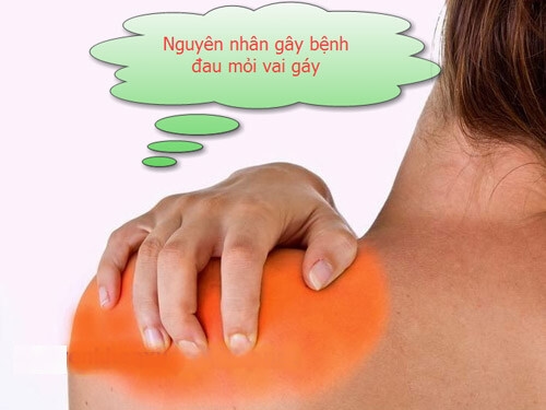 nguyên nhân gây đau mỏi vai gáy