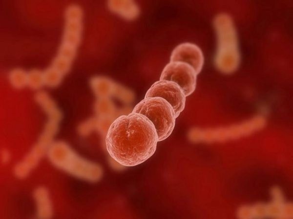 Viêm họng liên cầu khuẩn là gì?