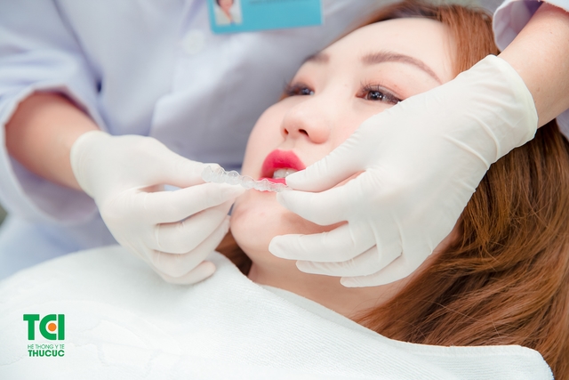 Công nghệ niềng răng Invisalign thế hệ mới