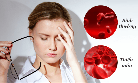 thiếu máu thiếu sắt