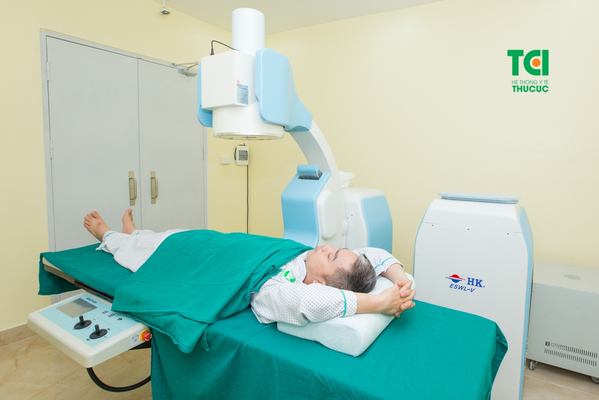 Sỏi thận canxi – loại sỏi chiếm hơn 80%  mắc sỏi thận