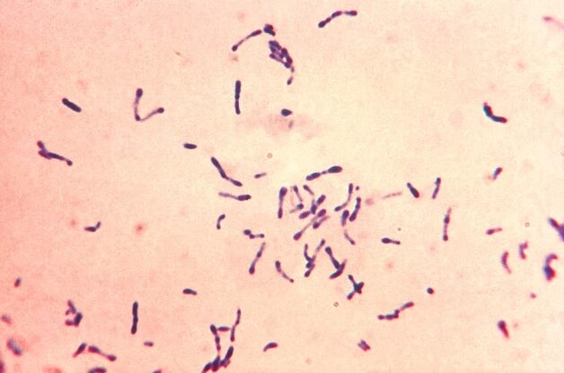 Trực khuẩn Corynebacterium diphtheriae là trực khuẩn gram dương, hình chùy