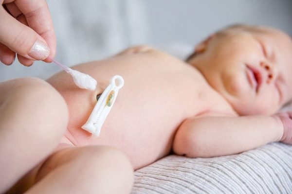 chăm sóc rốn cho trẻ