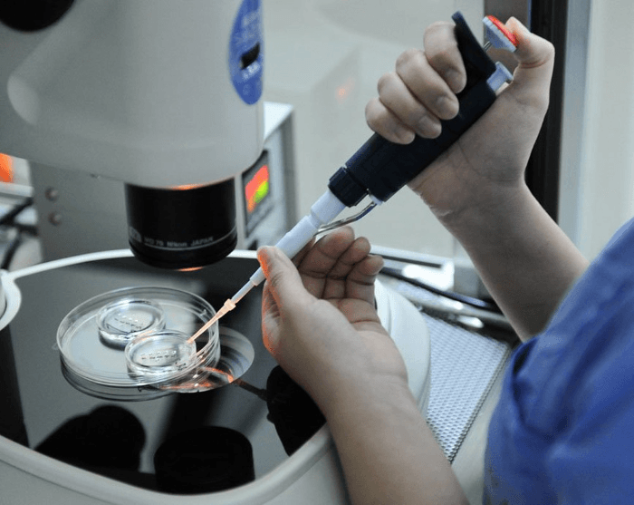 Tiêm tinh trùng vào bào tương trứng (ICSI) phù hợp cho nam giới bị tinh trùng yếu, ít, kém chất lượng