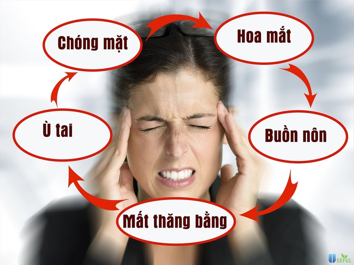 Bệnh rối loạn tiền đình là gì? Triệu chứng và cách điều trị