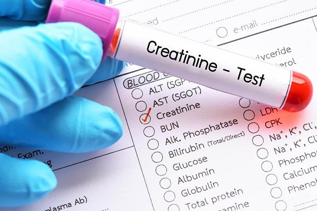 Đánh giá suy thận qua creatinin để phân loại các cấp độ suy thận