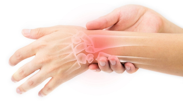 Hội chứng ống cổ tay &#8211; những kiến thức nhất định phải biết