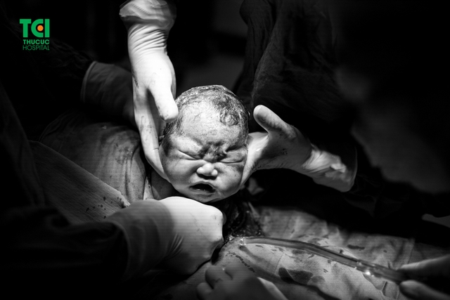 Diễn viên Mạnh Quân hồi hộp đưa vợ đi sinh vì vỡ ối sớm