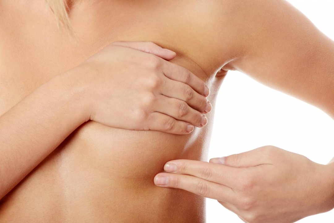 Bị áp xe vú kiêng ăn gì, nên ăn gì để nhanh hồi phục?