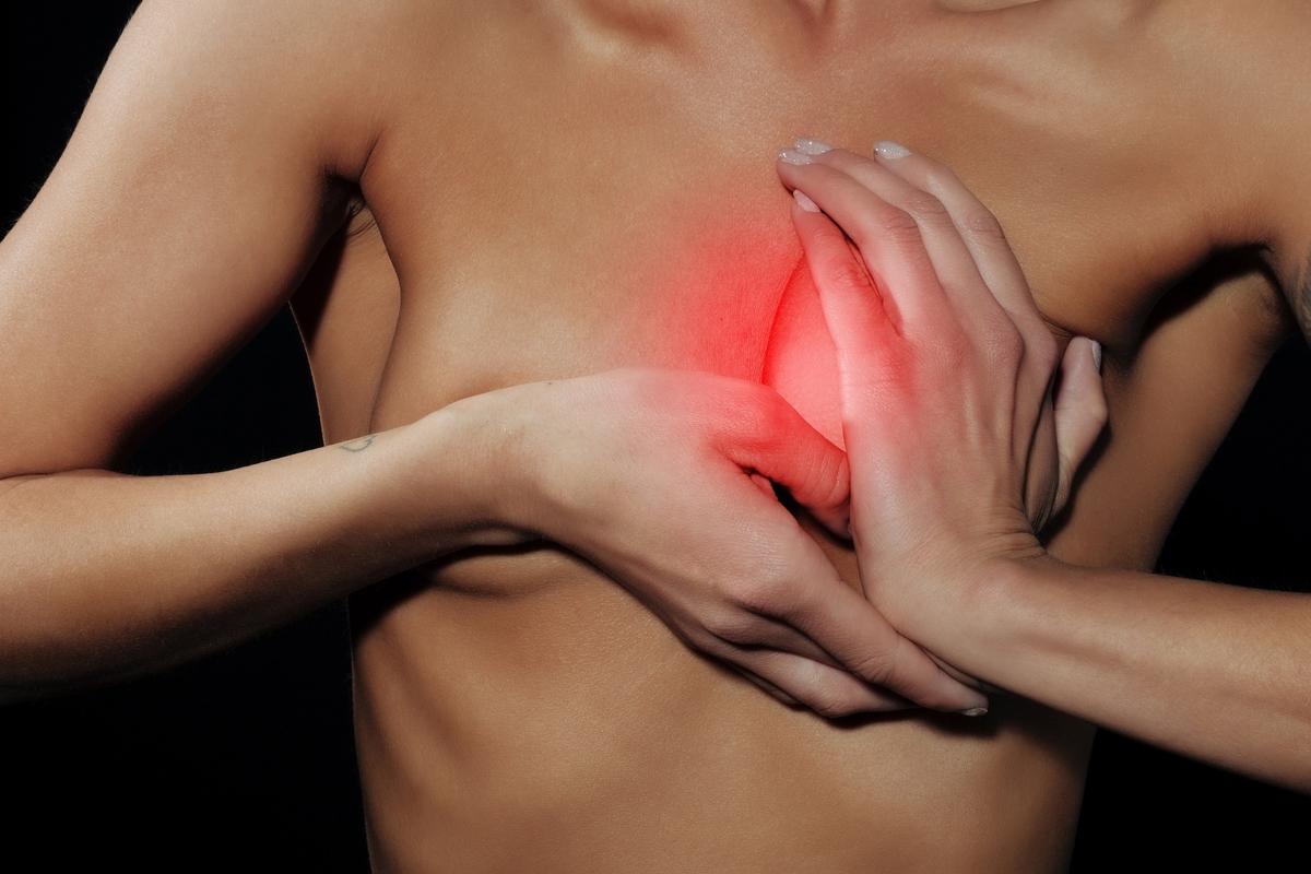 Áp xe vú là gì, nguyên nhân và cách điều trị như thế nào?