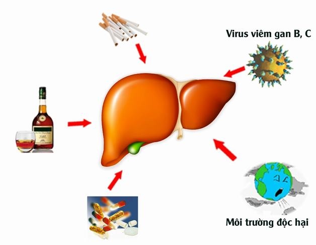 Nguyên nhân gây rối loạn chức năng gan