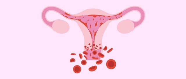 Bệnh lý Polyp cổ tử cung có nguy hiểm không?