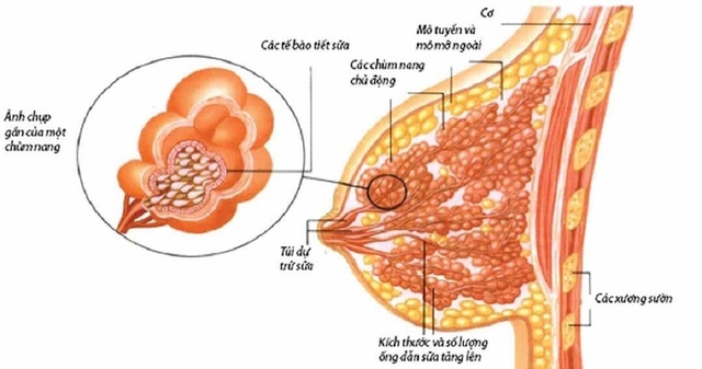 Những điều về u nang tuyến vú mà bạn cần biết rõ