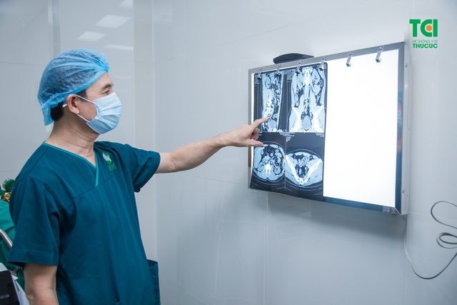 Tán sỏi công nghệ cao ít xâm lấn, sạch sỏi nhanh, êm ái