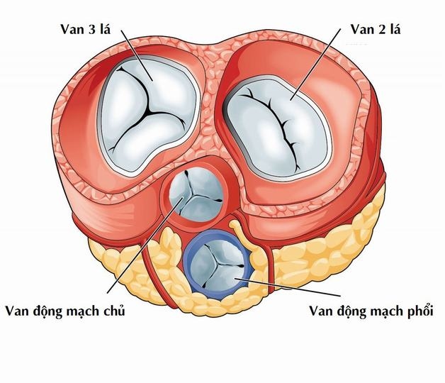 Các loại hẹp van tim 
