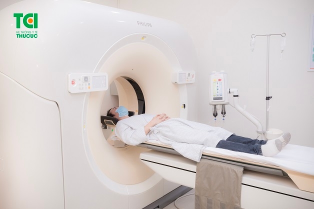 Chup CT là một phương pháp chẩn đoán thiếu máu não hiệu quả.