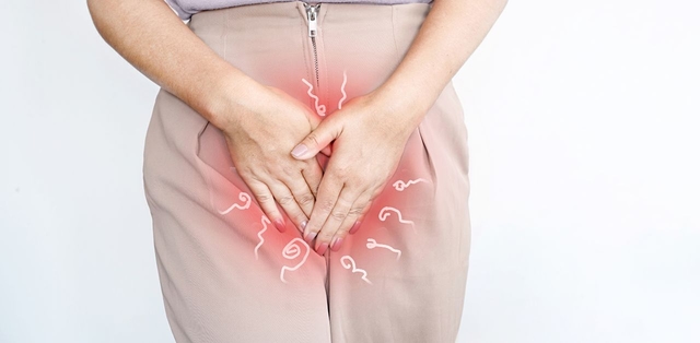 Nguy hiểm tiềm ẩn của hiện tượng ngứa quanh vùng kín phụ nữ