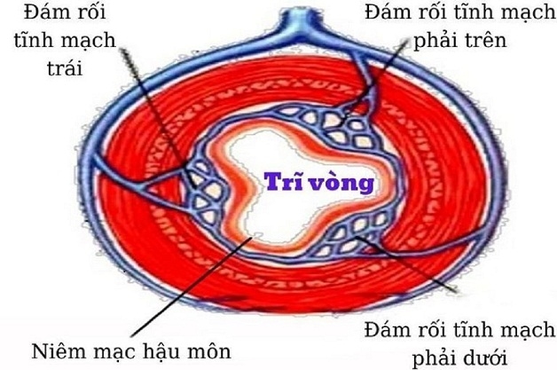 Cắt trĩ vòng được thực hiện như thế nào