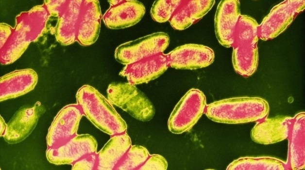 Ho gà do vi khuẩn ho gà Bordetella Pertussis gây ra