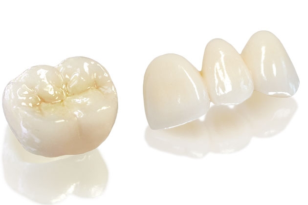 Bọc răng sứ toàn phần Katana