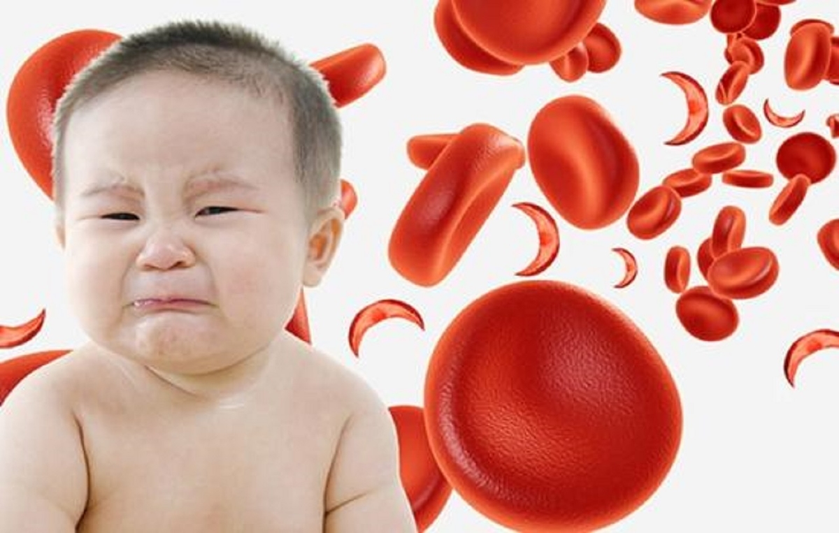 Tìm hiểu về căn bệnh thiếu máu não ở trẻ em