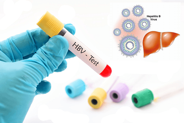 xét nghiệm HBV phát hiện bệnh gì