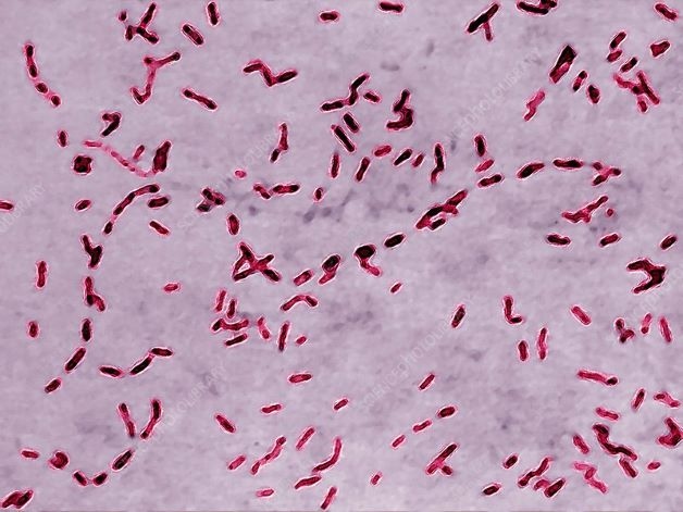 Ho gà là một bệnh truyền nhiễm phổ biến mỗi khi giao mùa, do vi khuẩn Bordetella pertussis gây ra.