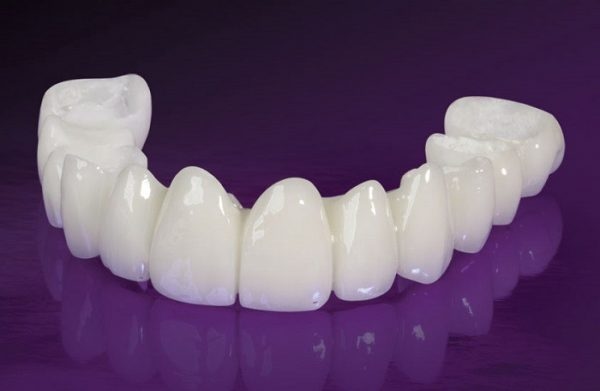 Răng sứ Cercon Đức là loại răng được khách háng sử dụng phổ biến