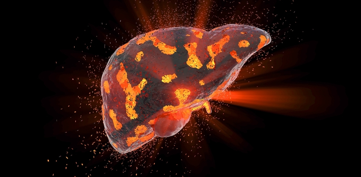 Viêm gan virus &#8211; Mối lo ngại lớn cho sức khỏe người bệnh