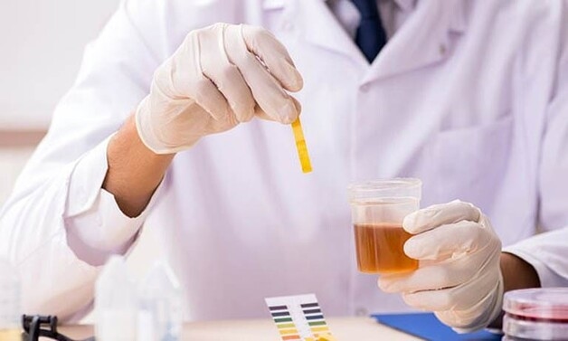 quy trình xét nghiệm nước tiểu 10 thông số 
