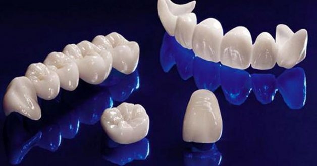 Răng toàn sứ có nhiều ưu điểm vượt trội và được sử dụng phổ biến hiện nay