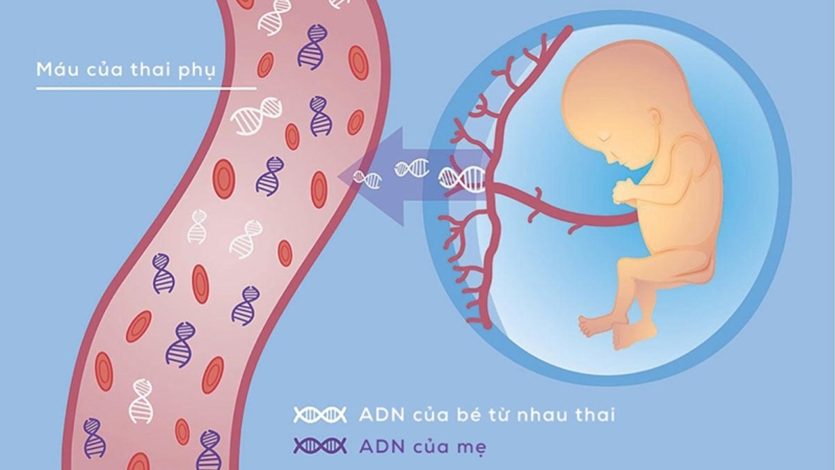 Xét nghiệm nipt ở đâu uy tín và cho kết quả chính xác