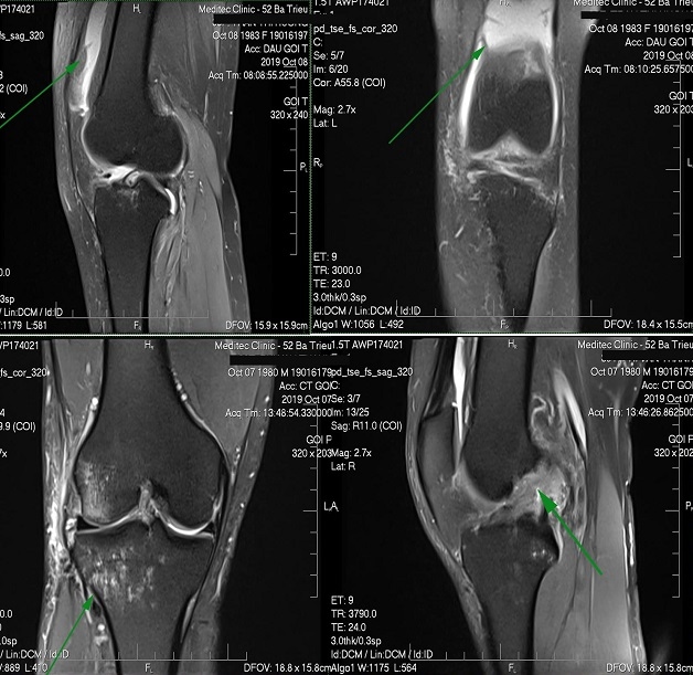 Kết quả chụp MRI cho thấy những hình ảnh rõ nét ở từng vùng chụp