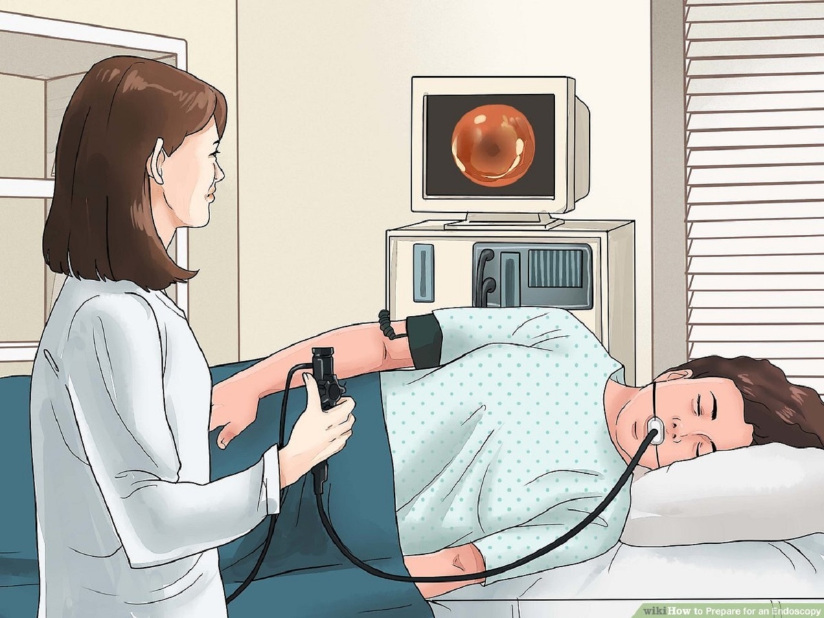 Nội soi ống mềm đường tiêu hóa trên là gì? Cách thực hiện