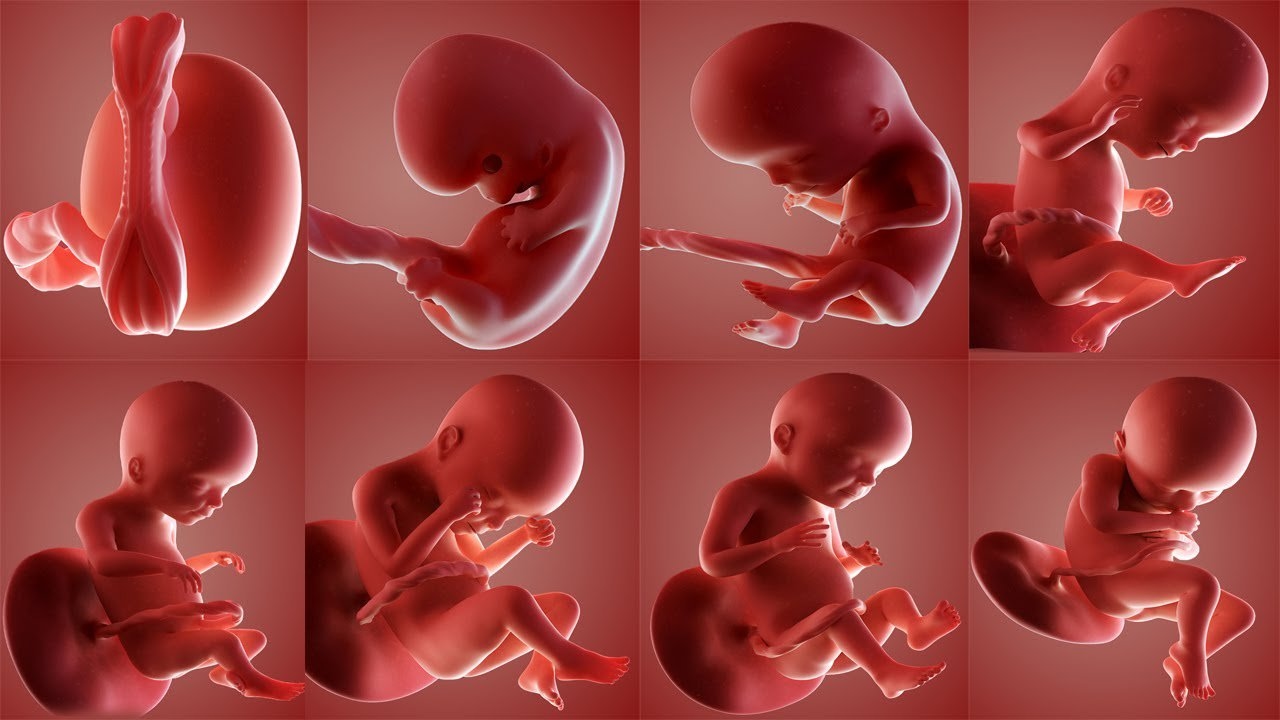 Thai nhi gò méo bụng là hiện tượng thế nào?