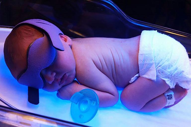 Chiếu đèn là một trong những biện pháp phổ biến được sử dụng để điều trị vàng da cho trẻ