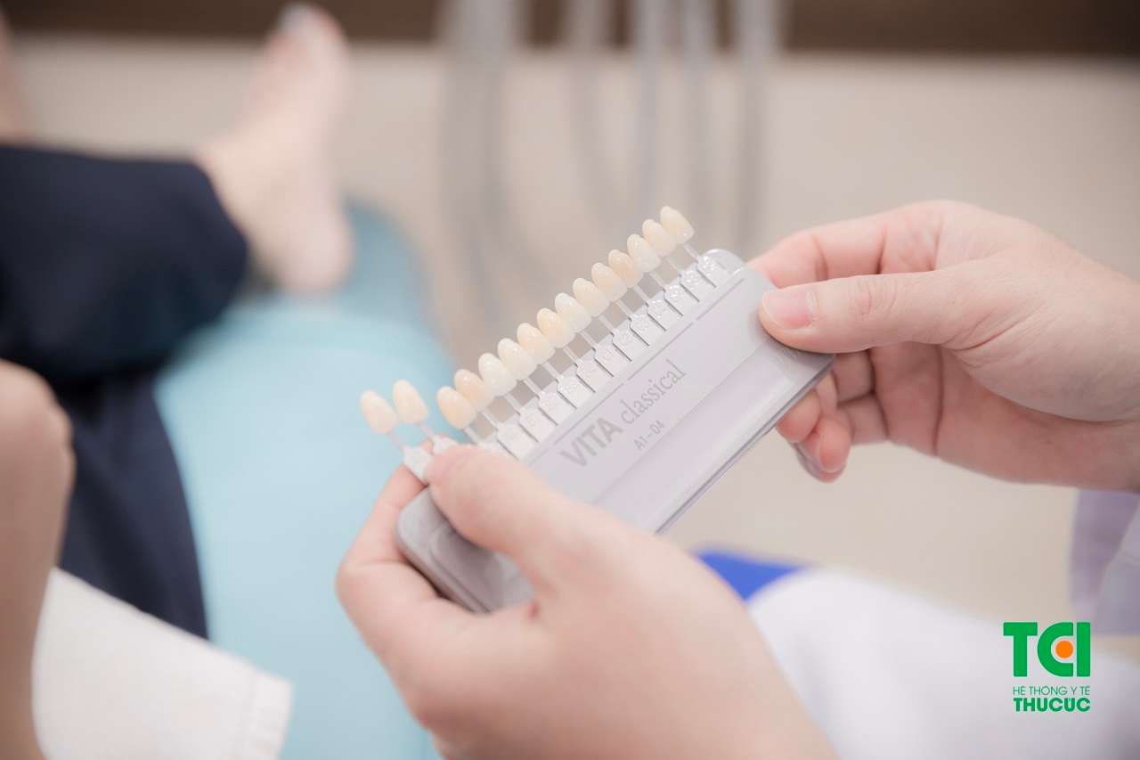 Nhiều người băn khoăn có nên tẩy trăng răng không?