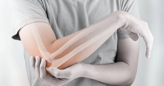 viêm điểm bán gân khuỷu tay
