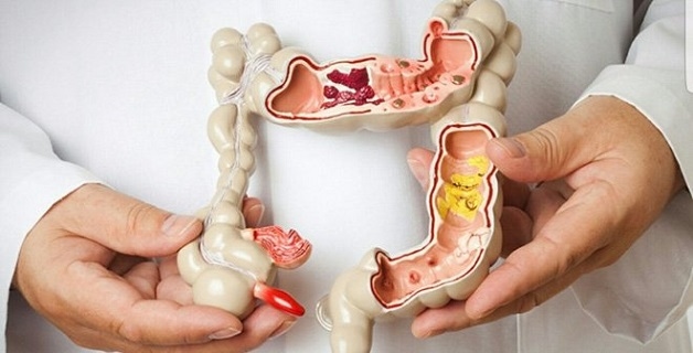 Việc xạ trị ung thư đại trực tràng cần được tiến hành tại các cơ sở uy tín để đảm bảo hiệu quả điều trị, hạn chế các tác dụng phụ của quá trình điều trị.