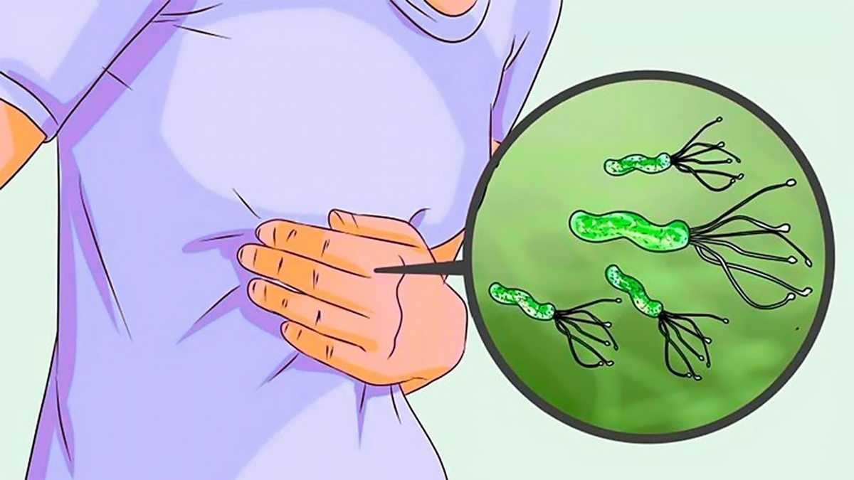 Vi khuẩn HP bao tử có nguy hiểm không? Cách điều trị