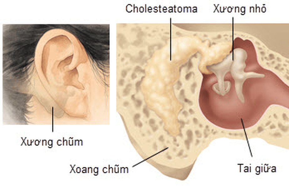 Vị trí xương chũm trong cơ thể